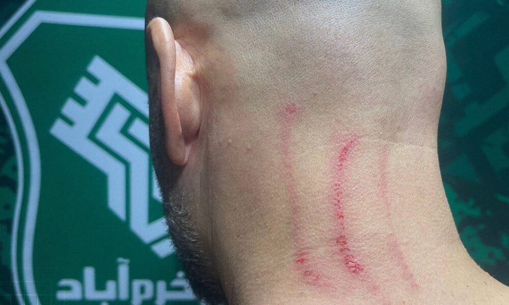 حمله به کادر استقلال بعد از تساوی برابر خیبر +عکس